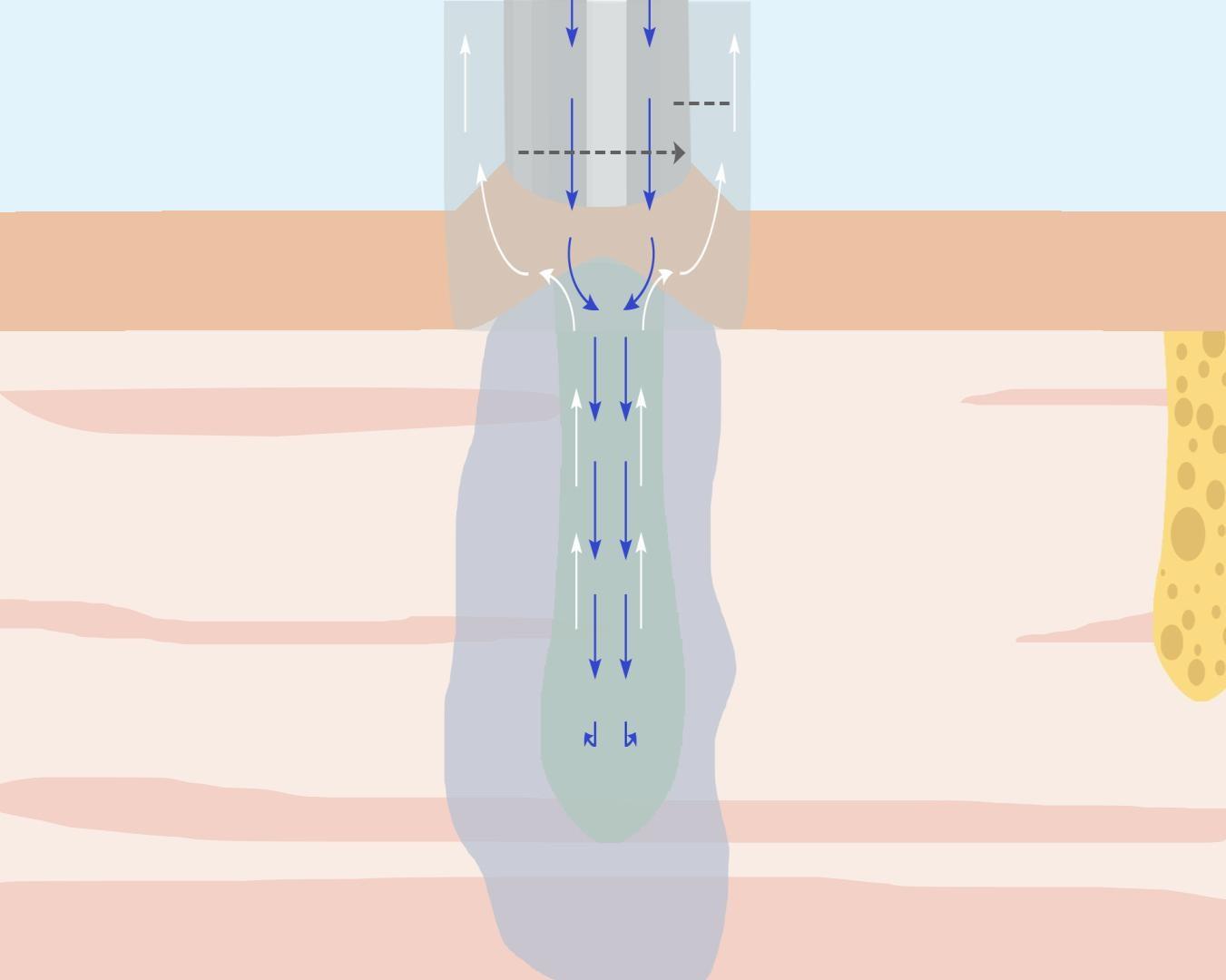 洗浄後の再保湿で、毛穴を潤す
