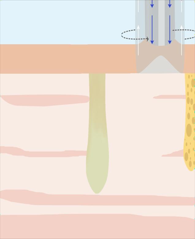 毛穴が清潔な状態に
